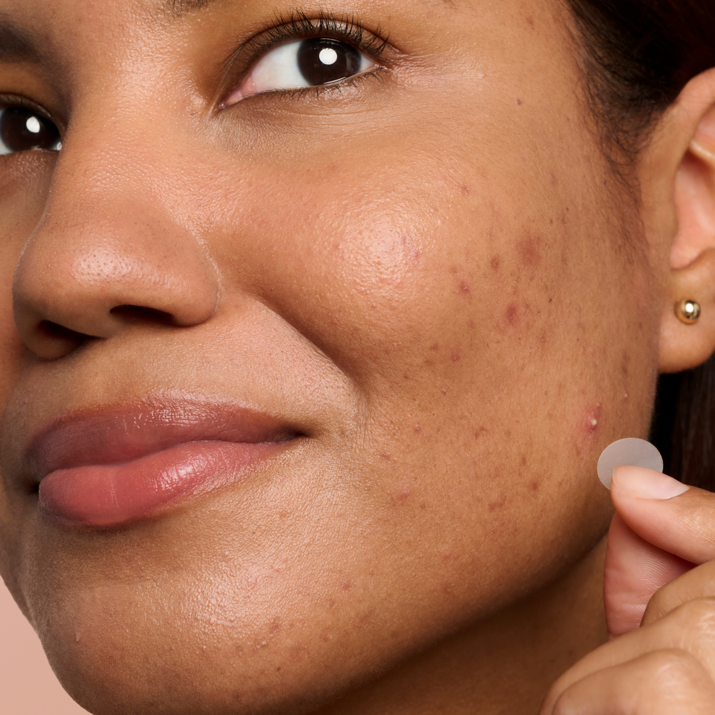Blemish Control Duo - Blemish Pair