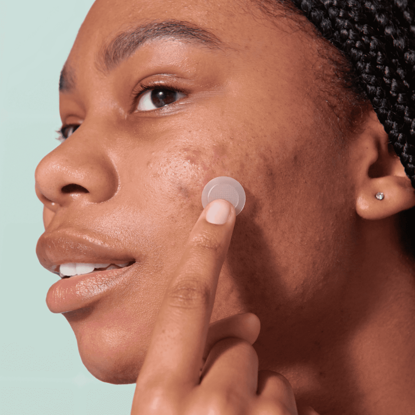 Mighty Patch™ for Early-Stage Blemishes - Clear Relief