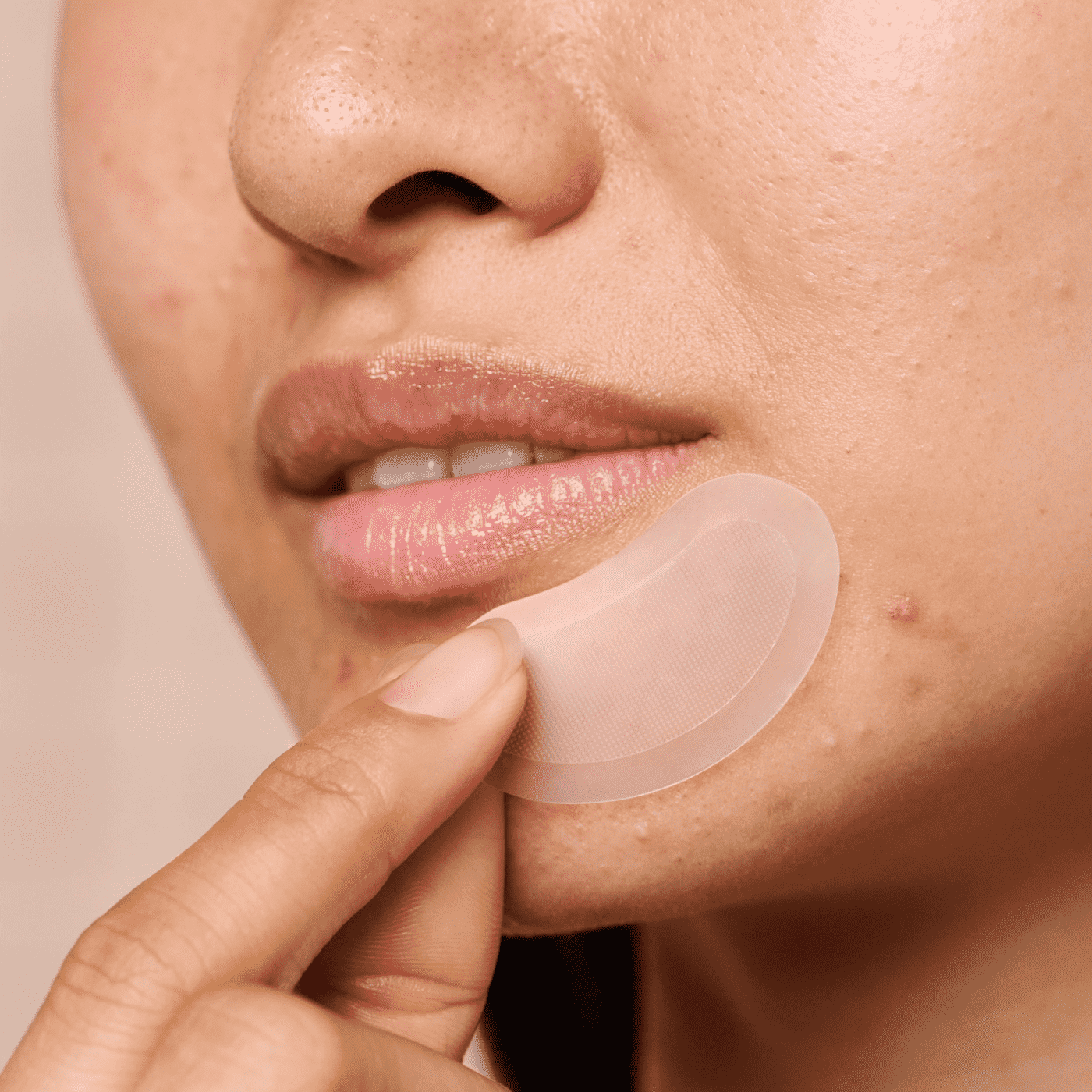 Mighty Patch™ for XL Early-Stage Blemishes - Spot Reset