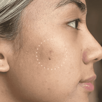 Mighty Patch™ for Dark Spots - Smooth Tone